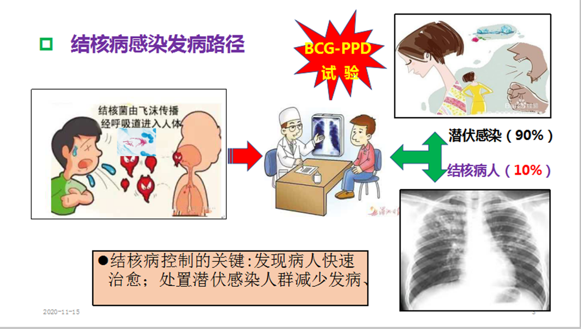 结核病感染发病途径.png